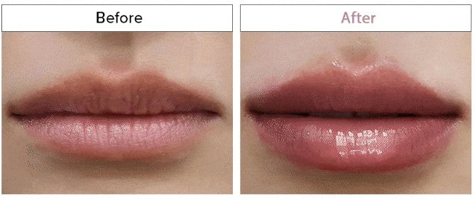 Snowtox Crystal Volume Lip Plumper 10-Box Wholesale Pack – No More, No Less