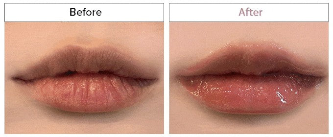 Snowtox Crystal Volume Lip Plumper 10-Box Wholesale Pack – No More, No Less